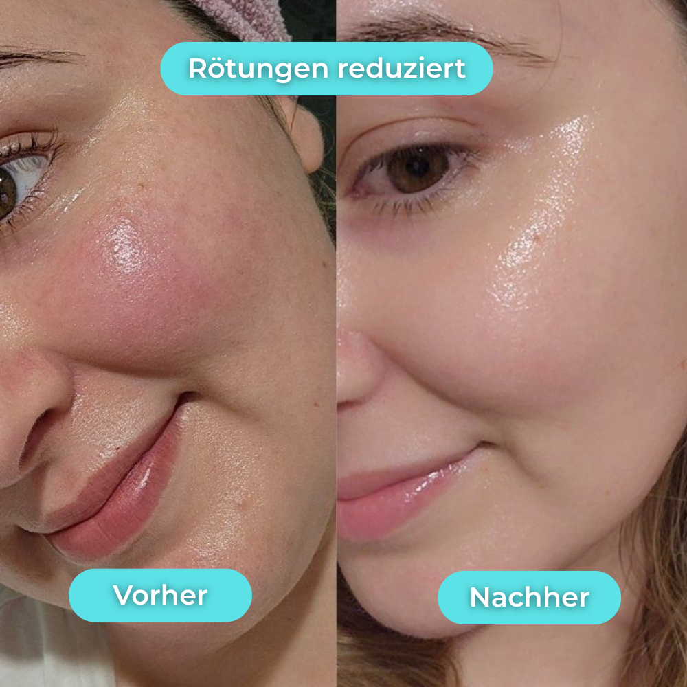 GLACIA™ – Der virale Ice Glow für deine Morgenroutine