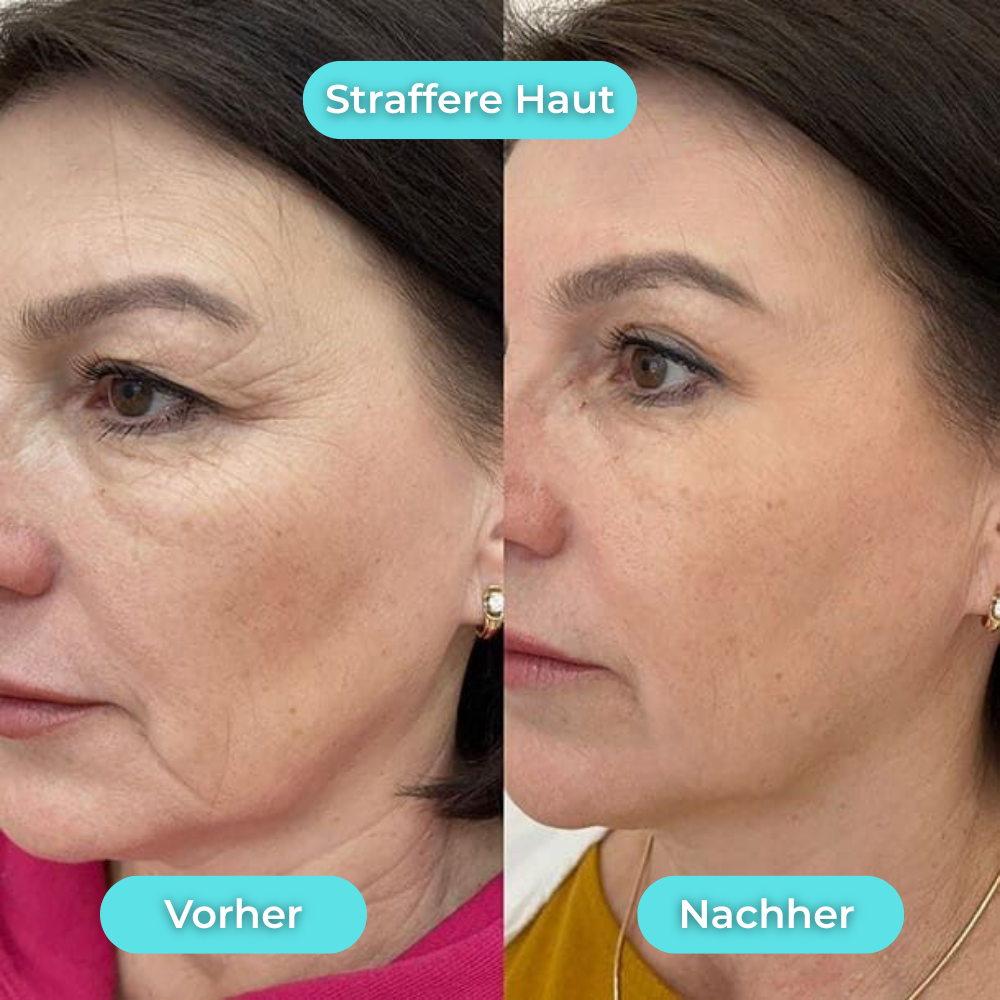 GLACIA™ – Der virale Ice Glow für deine Morgenroutine