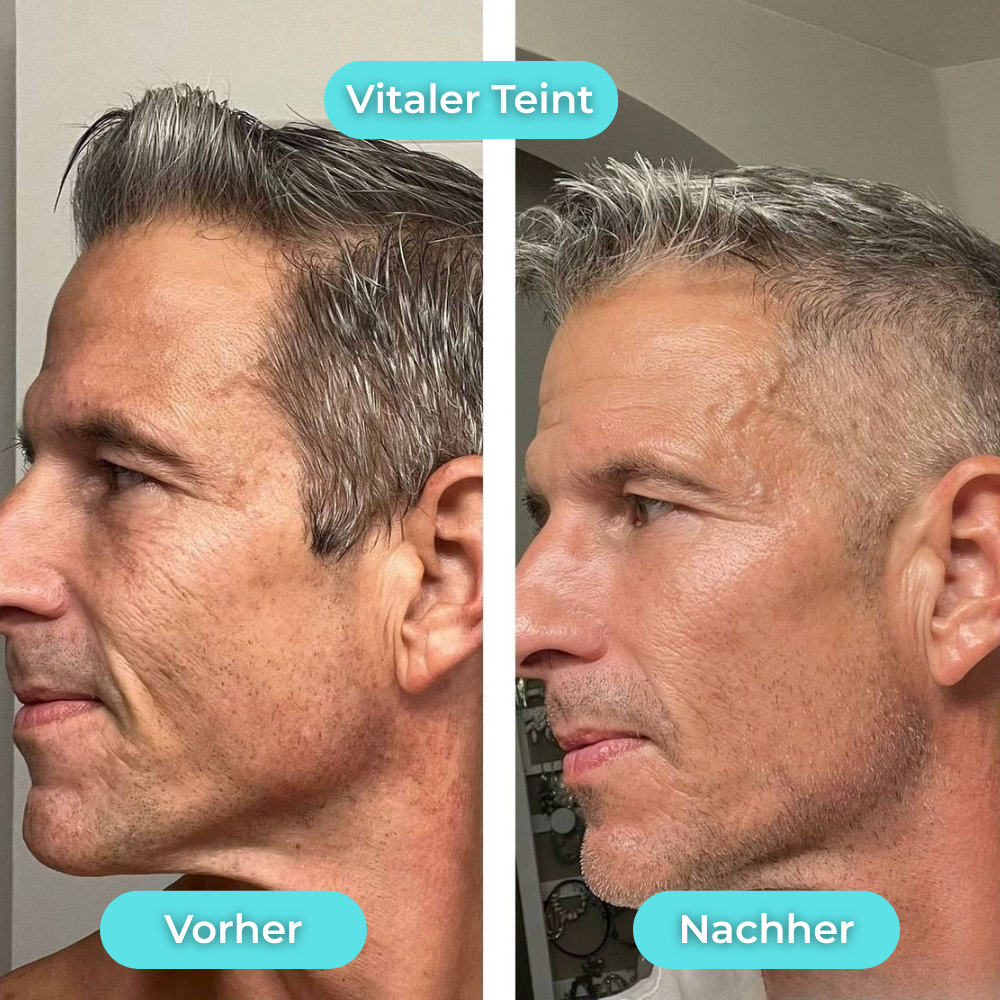 GLACIA™ – Der virale Ice Glow für deine Morgenroutine